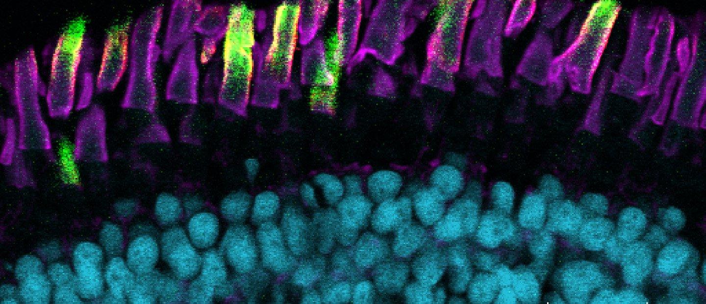 A cross section of eye tissue under a microscope.